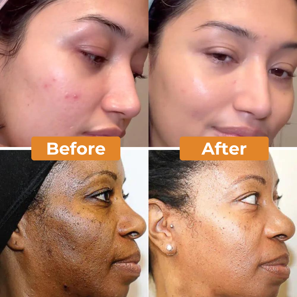 Radiant Tumeric Soap Bar